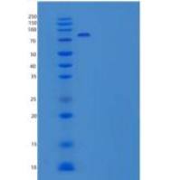 人肝配蛋白A受体1(EPHA1)重组蛋白Fc Tag