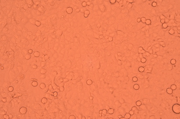 PANC-1, 人胰腺癌细胞产品信息