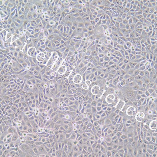 ACT-1 人甲状腺癌细胞/STR鉴定/镜像绮点（Cellverse）
