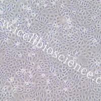 ACT-1 | ACT-1细胞 | ACT1细胞 | ACT1 | 人甲状腺癌细胞 | STR鉴定