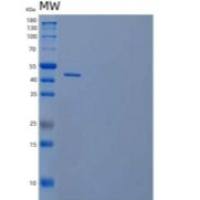 人4-1BB配体/4-1BBL/TNFSF9/CD137L重组蛋白N-Fc