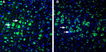 Anti-NETO1 (extracellular)