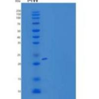 人SLAM家族成员5/SLAMF5/CD84重组蛋白C-6His