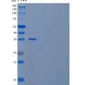 人富含亮氨酸的α-2糖蛋白重组蛋白