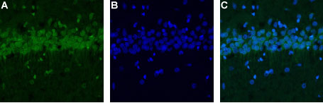 Anti-Calcium Homeostasis Modul