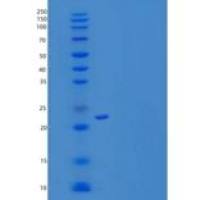 小鼠SLAM家庭成员2重组蛋白