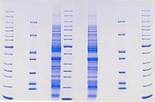 SDS-PAGE预制胶使用效果图