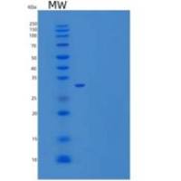 人OTUB1 / OTB1重组蛋白His tag