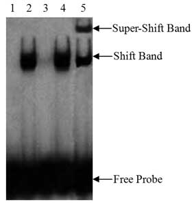 化学发光法生物素标记核酸检测试剂盒北京厂家现货