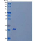 小鼠IAP/OA3/CD47重组蛋白C-6His
