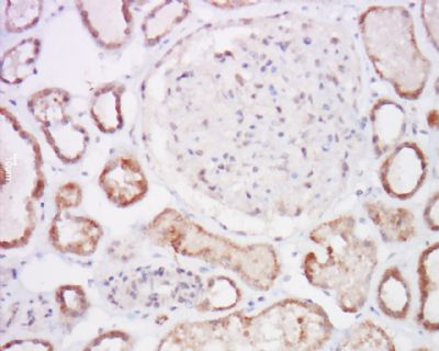 一种肿瘤抑制基因免疫荧光抗体(C端)
