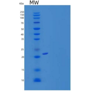 人UBE2F 重组蛋白His tag