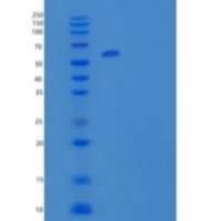 人醛脱氢酶1家族成员A2(ALDH1A2)重组蛋白