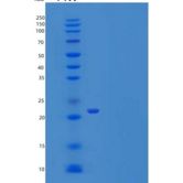 人UBE2T重组蛋白His Tag