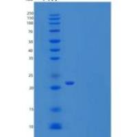 人UBE2T重组蛋白His Tag