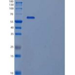 人Copine-1/CPNE1重组蛋白N, C-6His
