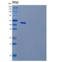 人转钴胺素ⅱ受体/TCblR/8D6A/CD320重组蛋白C-Fc