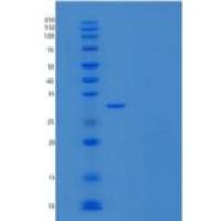 人NKG2A和CD94异二聚体重组蛋白N-8His & N-Flag