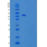 人丝氨酸蛋白酶抑制剂-进化枝B9重组蛋白