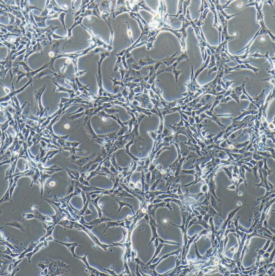 U-87MG-RFP 人脑星形胶质母细胞瘤（红色标记 ）/镜像绮点（Cellverse）