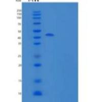人细胞质蛋白NCK1重组蛋白