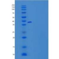 小鼠t细胞表面糖蛋白CD5重组蛋白