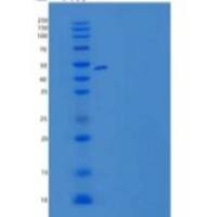人SLAM家族成员6/SLAMF6/CD352/NTB-A重组蛋白C-Fc