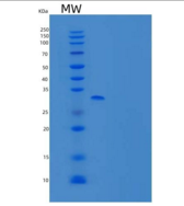 人Syntenin-1/SDCBP/SYCL/MDA9重组蛋