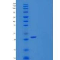 人干细胞因子/SCF/c-Kit配体重组蛋白C-6His