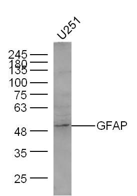 胶质纤维酸性蛋白抗体