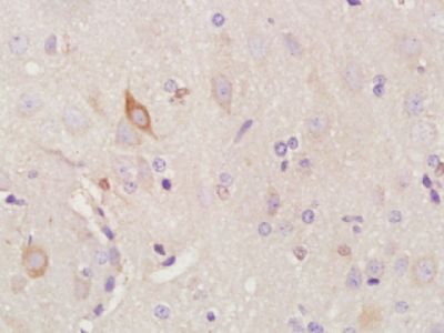 SOX2胚胎干细胞关键蛋白抗体