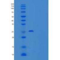 大鼠t淋巴细胞活化抗原CD80/B7-1重组蛋白C-6His