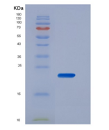 人CD16b / FCGR3B重组蛋白His tag