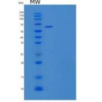 小鼠死亡受体6重组蛋白