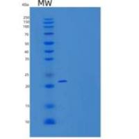 大鼠TNFR1 / CD120a / TNFRSF1A重组蛋白His tag