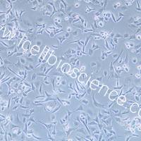 TOV-112D 人上皮性卵巢癌细胞/STR鉴定/镜像绮点(Cellverse)