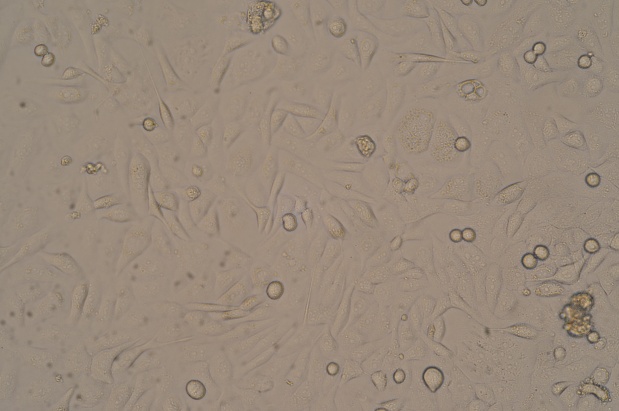 GBC-SD, 人胆囊癌细胞产品信息