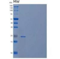 人含卷曲螺旋结构域的蛋白134/CCDC134重组蛋白C-6His
