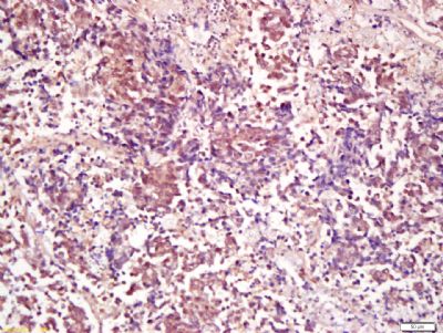 蛋白质磷酸酶-2A抗体