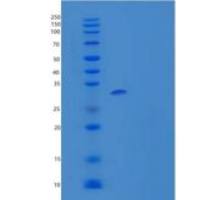 人适应蛋白耳结合外壳相关蛋白2/NECAP2重组蛋白N, C-6His