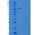 小鼠PDGFR α/PDGFRA/CD140a重组蛋白C-6His