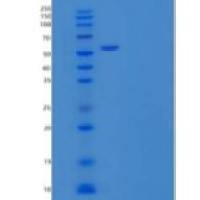 小鼠PDGFR α/PDGFRA/CD140a重组蛋白C-6His