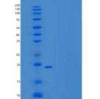 人Rad6重组蛋白His Tag