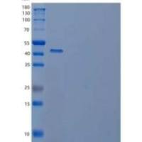 人胱硫醚γ-裂解酶/CTH重组蛋白