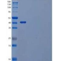 人TREML1/TLT-1重组蛋白C-Fc