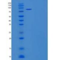 人CEACAM5/CD66e/CEA重组蛋白C-Fc