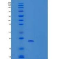 人过氧化还原酶5(PRDX5)重组蛋白N-6His