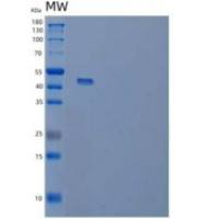 人肿瘤坏死因子受体I/TNFRSF1A/CD120a重组蛋白C-Fc