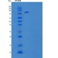 人多聚免疫球蛋白受体(PIGR)重组蛋白C-Fc