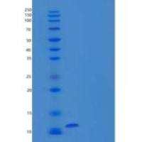人神经肽1样蛋白/NRN1L重组蛋白C-6His
